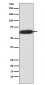 Anti-Phospho-S6K1 (T421 + S424) RPS6KB1 Rabbit Monoclonal Antibody