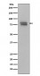 Anti-Phospho-v-Myb + c-Myb (S11) Rabbit Monoclonal Antibody