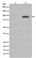 Anti-Phospho-beta Catenin (S33/S37) CTNNB1 Rabbit Monoclonal Antibody