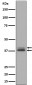 Anti-Phospho-Erk1 (T202/Y204) + Erk2 (T185/Y187) MAPK3 Rabbit Monoclonal Antibody