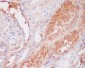 Anti-C9/Complement Component C9 Rabbit Monoclonal Antibody