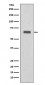 Anti-C9/Complement Component C9 Rabbit Monoclonal Antibody