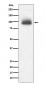 Anti-GR NR3C1 Rabbit Monoclonal Antibody