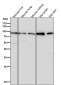 Anti-GR NR3C1 Rabbit Monoclonal Antibody