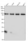 Anti-GR NR3C1 Rabbit Monoclonal Antibody