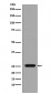 Anti-GST GSTP1 Rabbit Monoclonal Antibody