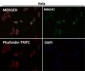 Anti-NGF/Beta Ngf Rabbit Monoclonal Antibody