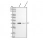 Anti-NGF/Beta Ngf Rabbit Monoclonal Antibody