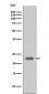 Anti-Bim BCL2L11 Rabbit Monoclonal Antibody