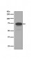 Anti-5T4 TPBG Rabbit Monoclonal Antibody