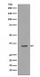 Anti-TBP/Tata Binding Protein Tbp Rabbit Monoclonal Antibody