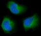 Anti-FAK PTK2 Rabbit Monoclonal Antibody