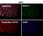 Anti-p53 TP53 Rabbit Monoclonal Antibody