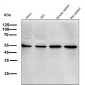 Anti-p38 MAPK14 Rabbit Monoclonal Antibody