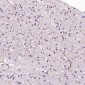 Anti-CD8 CD8A Rabbit Monoclonal Antibody