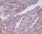 Anti-5T4 TPBG Rabbit Monoclonal Antibody