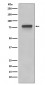 Anti-5T4 TPBG Rabbit Monoclonal Antibody