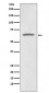 Anti-p73 Rabbit Monoclonal Antibody