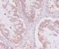 Anti-NSE ENO2 Rabbit Monoclonal Antibody