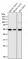 Anti-p63 TP63 Rabbit Monoclonal Antibody