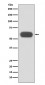 Anti-GBA/Glucosylceramidase Rabbit Monoclonal Antibody