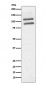 Anti-PML Rabbit Monoclonal Antibody