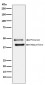 Anti-DR5 Rabbit Monoclonal Antibody