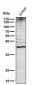 Anti-DR5 Rabbit Monoclonal Antibody