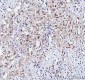 Anti-PRC1 Rabbit Monoclonal Antibody