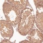 Anti-CDK2 Rabbit Monoclonal Antibody