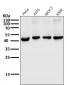Anti-MEK1 MAP2K1 Rabbit Monoclonal Antibody