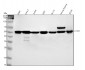 Anti-Chk1 CHEK1 Rabbit Monoclonal Antibody