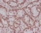 Anti-MLH1 Rabbit Monoclonal Antibody