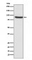 Anti-MLH1 Rabbit Monoclonal Antibody