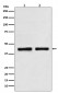 Anti-SNF5 SMARCB1 Rabbit Monoclonal Antibody