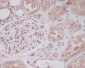 Anti-Nrf2 NFE2L2 Rabbit Monoclonal Antibody