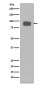 Anti-CD44 Rabbit Monoclonal Antibody