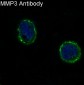 Anti-MMP3 Rabbit Monoclonal Antibody