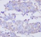 Anti-MMP2 Rabbit Monoclonal Antibody