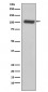 Anti-PSMA FOLH1 Rabbit Monoclonal Antibody