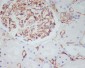 Anti-CD34 Rabbit Monoclonal Antibody