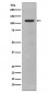 Anti-CD34 Rabbit Monoclonal Antibody