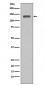 Anti-MCM2 Rabbit Monoclonal Antibody