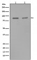 Anti-MMP9 Rabbit Monoclonal Antibody