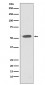 Anti-CD47 Rabbit Monoclonal Antibody