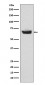 Anti-CETP Rabbit Monoclonal Antibody