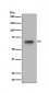 Anti-S6K1 RPS6KB1 Rabbit Monoclonal Antibody