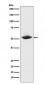 Anti-MMP1 Rabbit Monoclonal Antibody