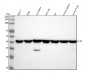 Anti-CCR7 Rabbit Monoclonal Antibody