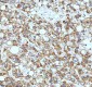 Anti-ASK1 MAP3K5 Rabbit Monoclonal Antibody